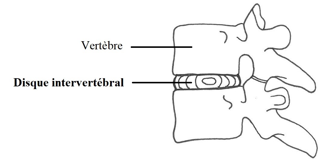 Disque intervertébral (vue latérale)